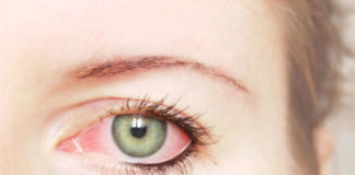 Pink Eye